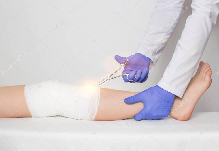 Diz Kapak Çatlağında Kaç Günde Alçı Çıkarılır?